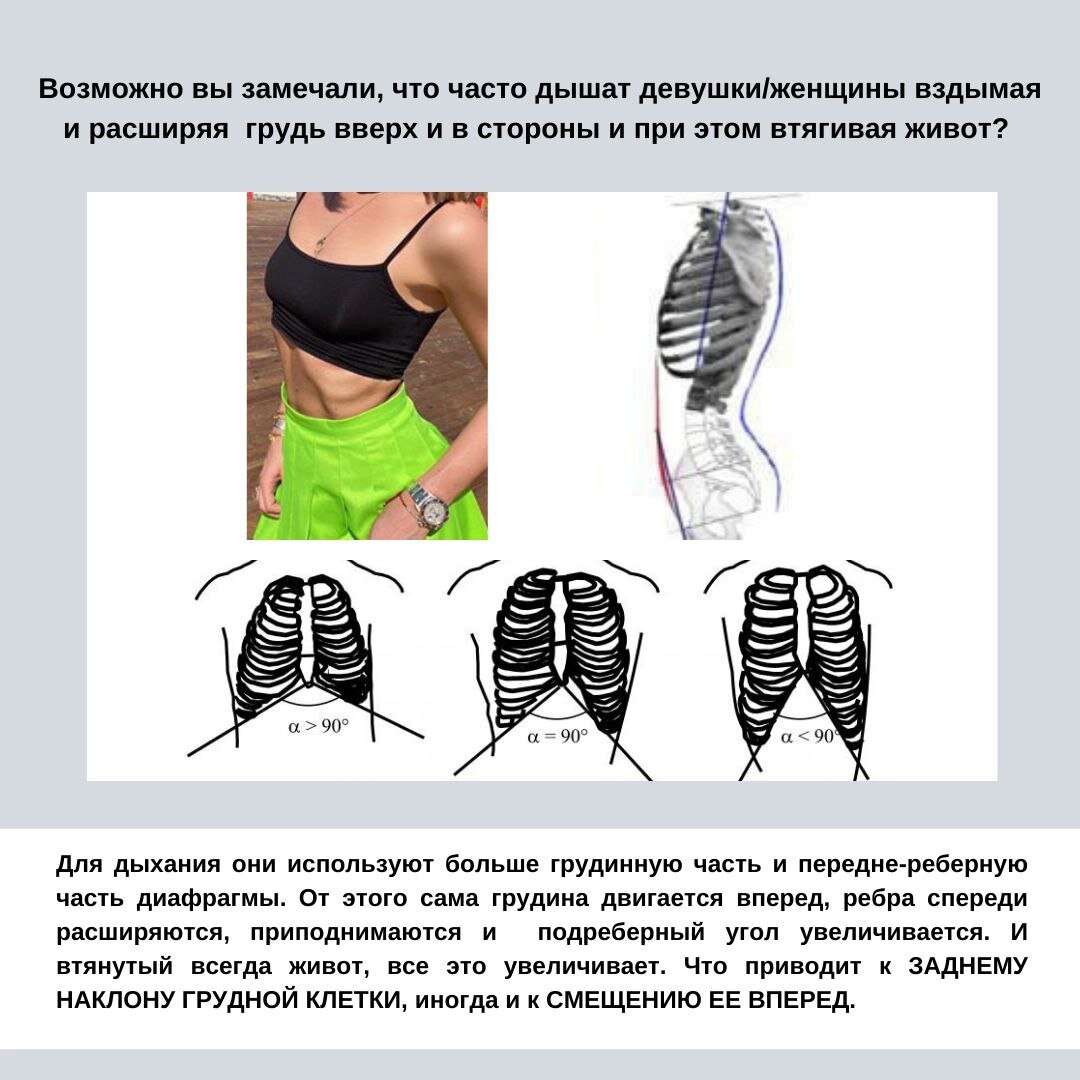 Возможно вы замечали, что часто дышат девушки/женщины вздымая и расширяя грудь вверх и в стороны и при этом втягивая живот, как на фото выше? ⠀
Для дыхания они используют больше грудинную часть и передне-реберную часть диафрагмы.
⠀
От этого сама грудина двигается вперед, ребра спереди расширяются, приподнимаются и  подреберный угол увеличивается. И втянутый всегда живот, все это увеличивает. Что приводит к ЗАДНЕМУ НАКЛОНУ ГРУДНОЙ КЛЕТКИ, иногда и к СМЕЩЕНИЮ ЕЕ ВПЕРЕД.