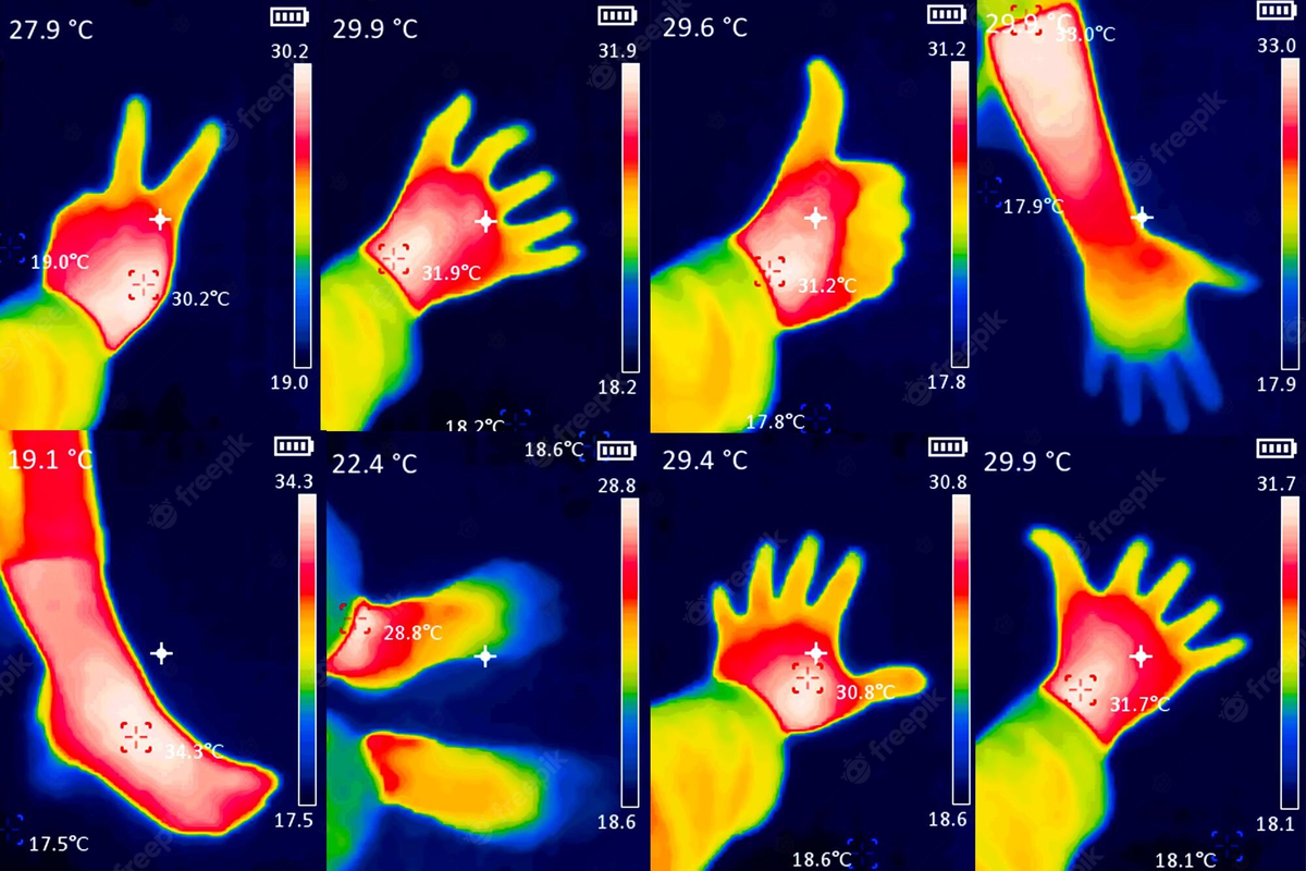 Инфракрасное излучение термография. Термографическое изображение. Термограмма кисти. Температура рук человека. Руки разной температуры