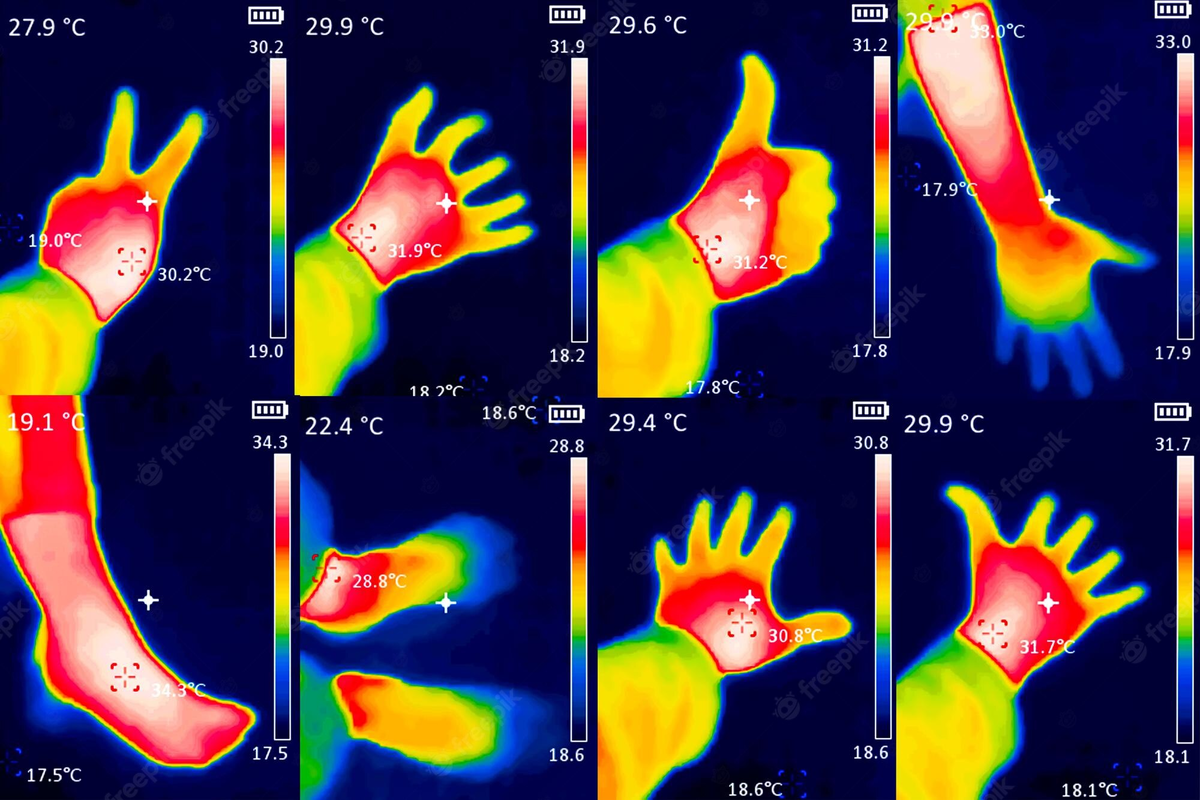 Температура рук. Термограмма кисти.