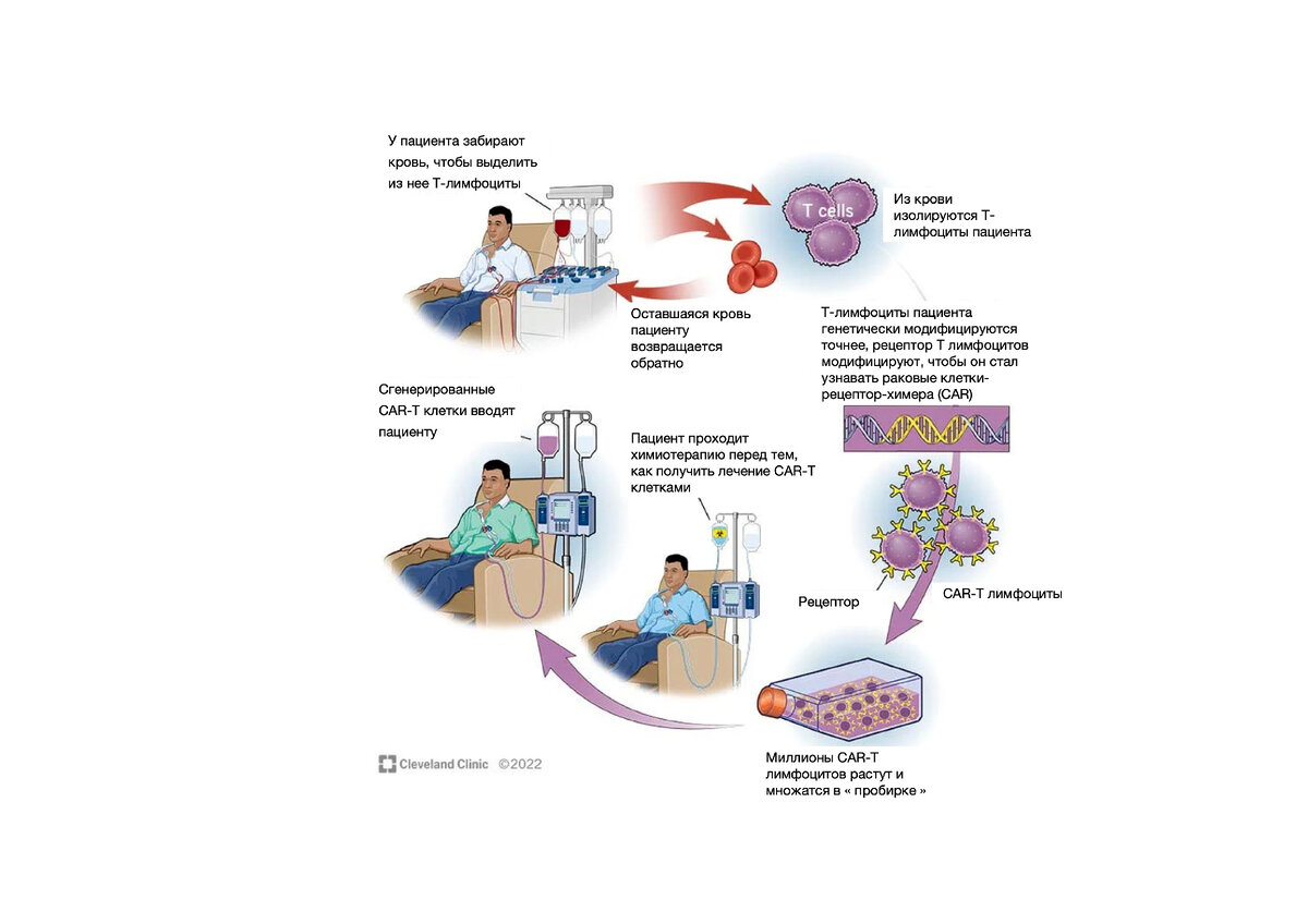 CAR T cell терапия