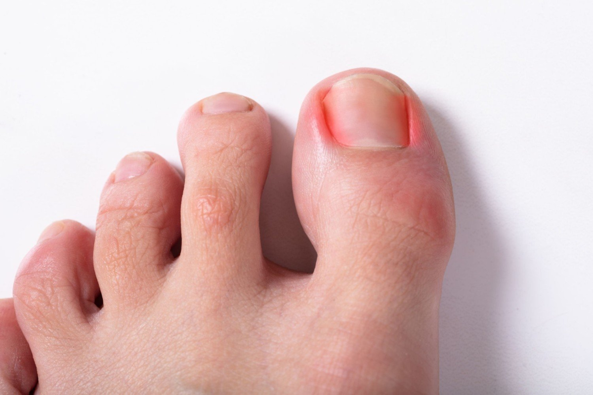 Последствия травм и ношения неудобной обуви