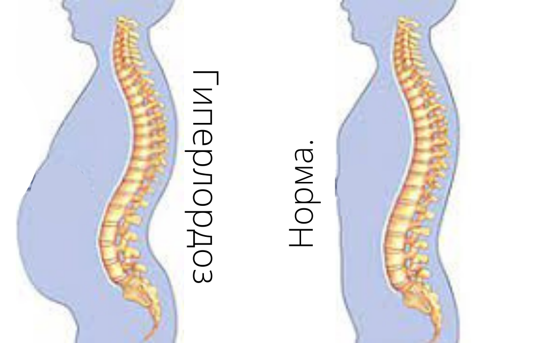 Источник: Яндекс. Картинки