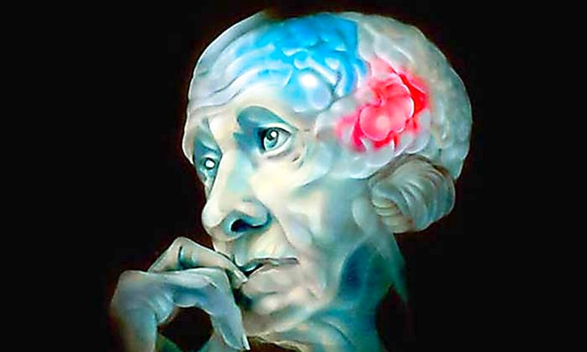 Деменция ума. Старение мозга. Мозг в старости. Мозг старика.