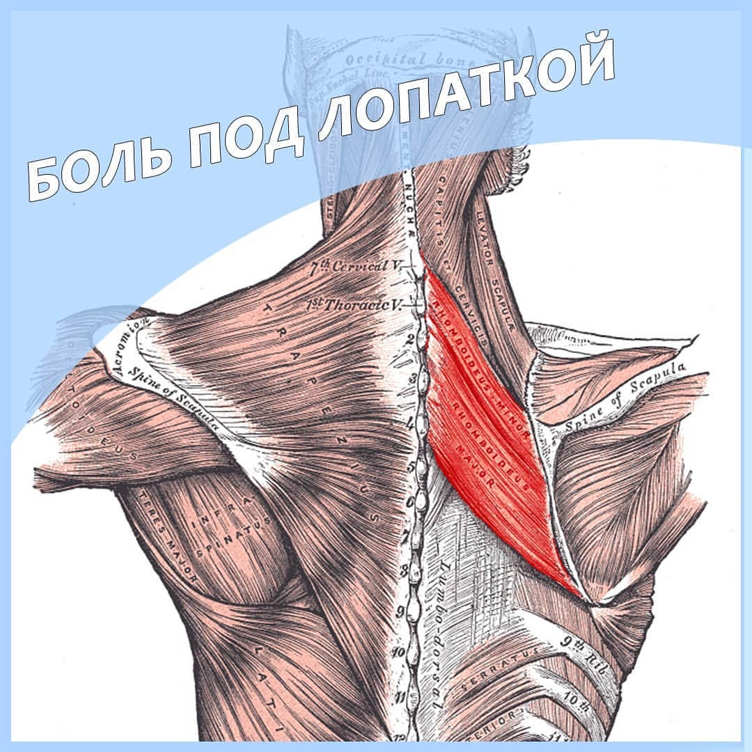 Триггерные точки под лопаткой