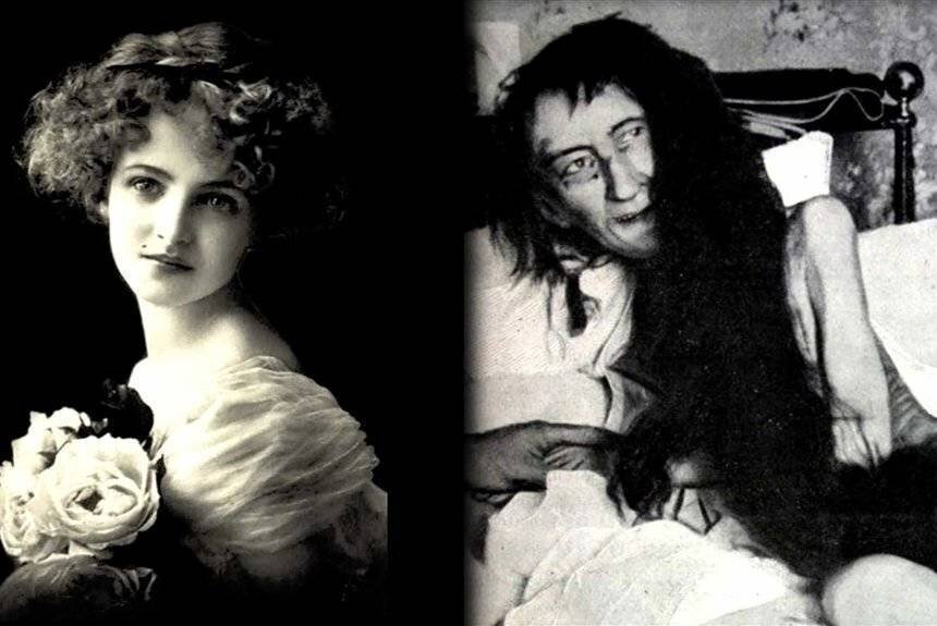 Бланш Монье. В молодости и после освобождения. Источник: Яндекс картинки