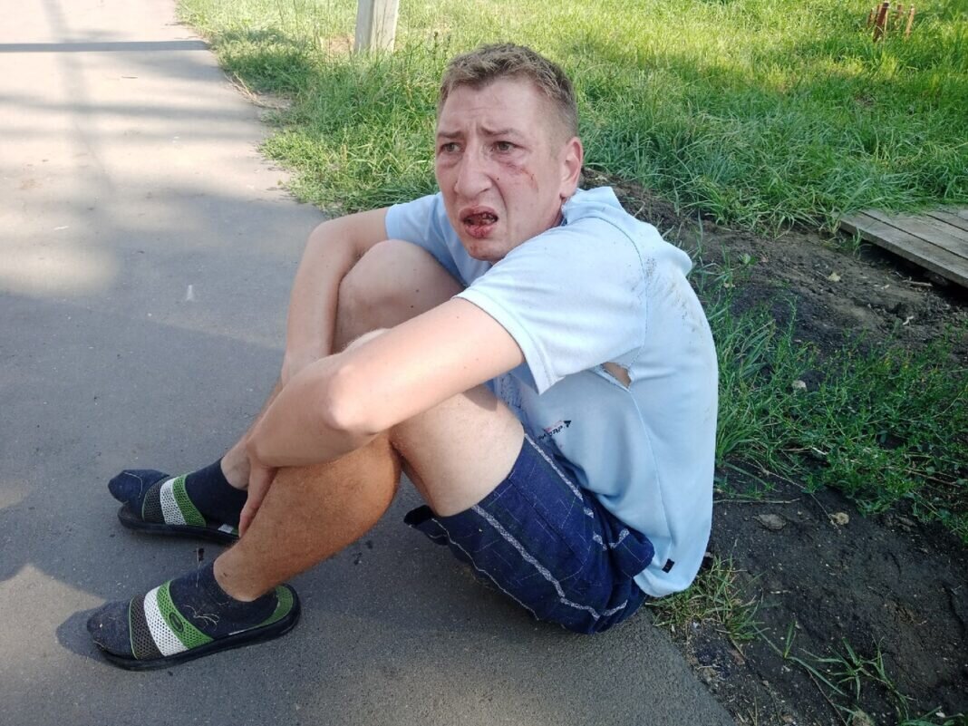 В Ряжске трое подростков жестоко избили инвалида детства и его мать |  Новости 7info.ru | Дзен