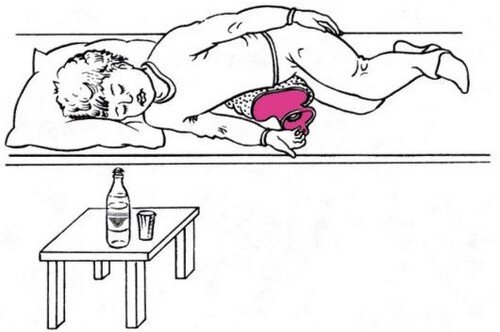 Тюбажное положение