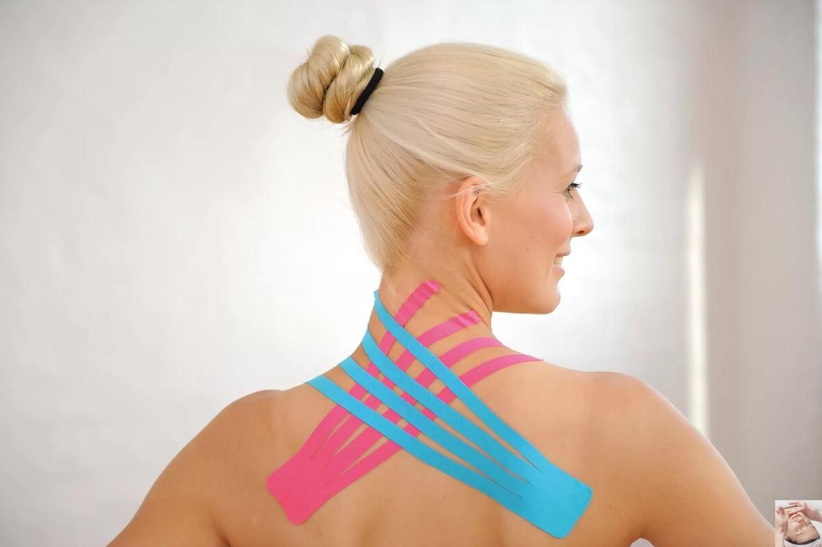 Тейпирование плечевого пояса