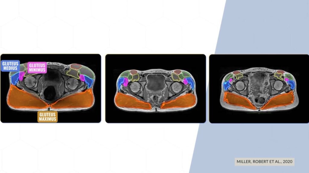 Оранжевым цветом — большая ягодичная, синим — средняя ягодичная, фиолетовым — малая ягодичная. 