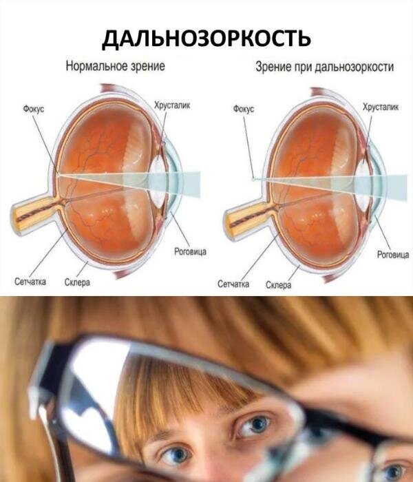 Картинка из источника https://glazclinic.com/kakiye-laboratorniye-issledovaniya-neobhodimiy.html