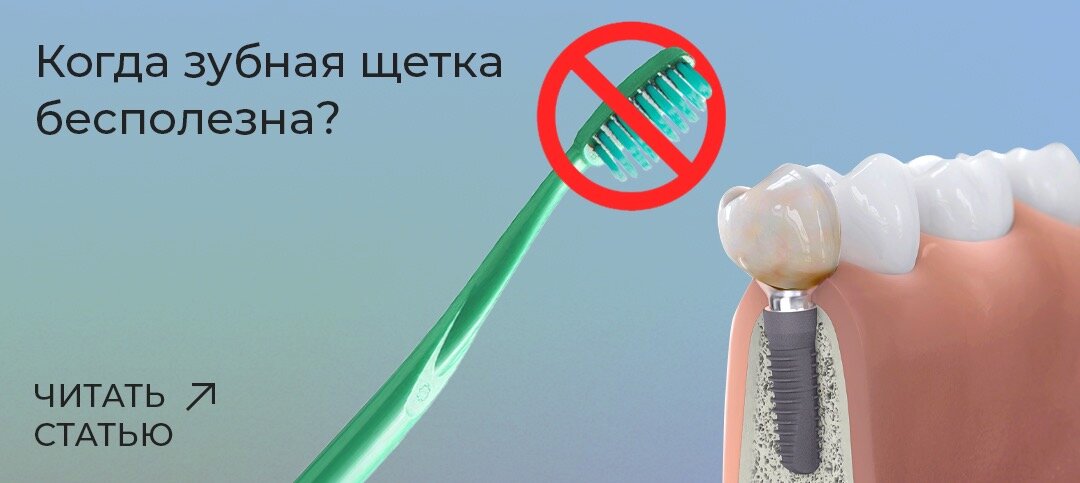 Профессиональная гигиена полости рта: чистка зубов