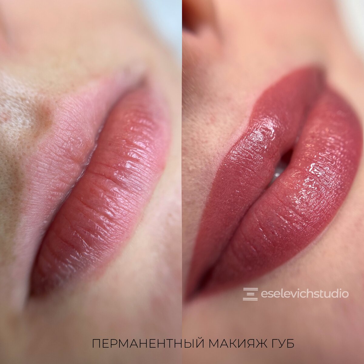 Восстановление природной каймы губ. Цвет подобрали максимально под свой ц | Instagram