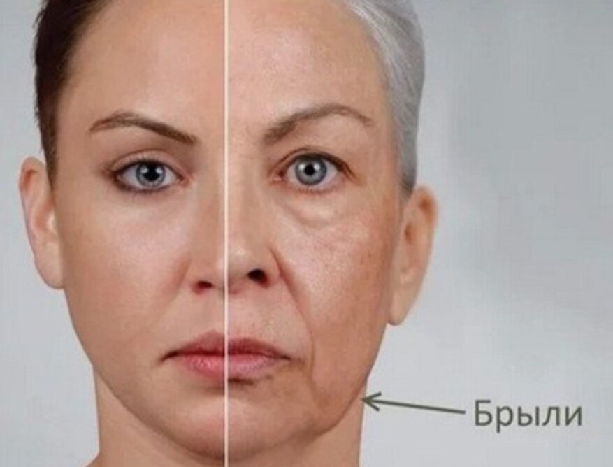 Ох уж эти брыли))