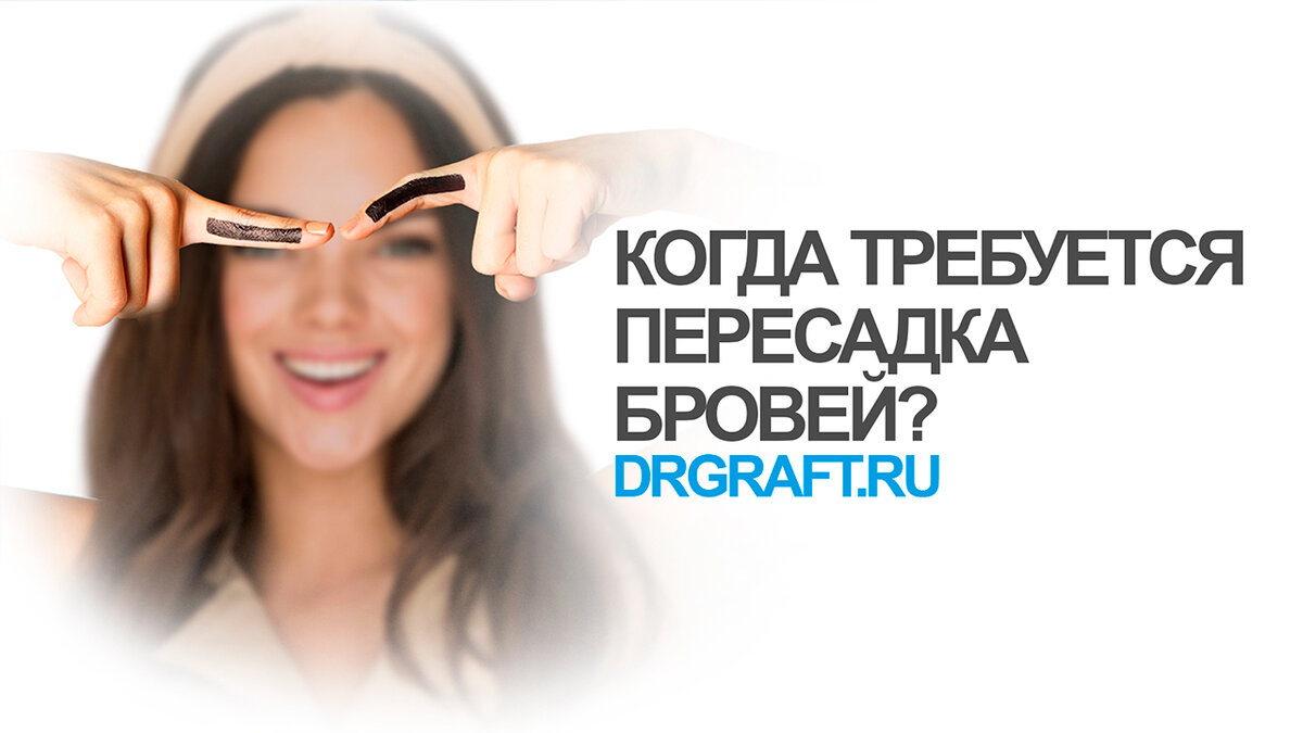 Когда требуется пересадка бровей.