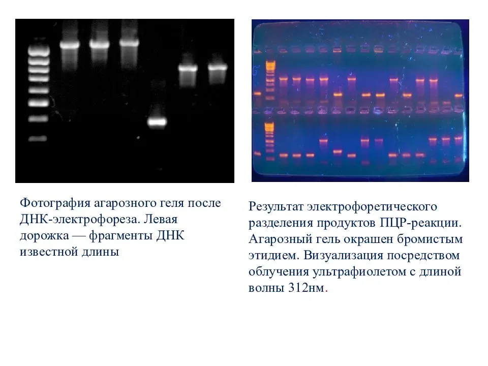 Тест песня электрофорез. Электрофореграмма результатов ПЦР. Метод ПЦР гель электрофорез. ПЦР агарозный гель. Гель электрофорез ПЦР.