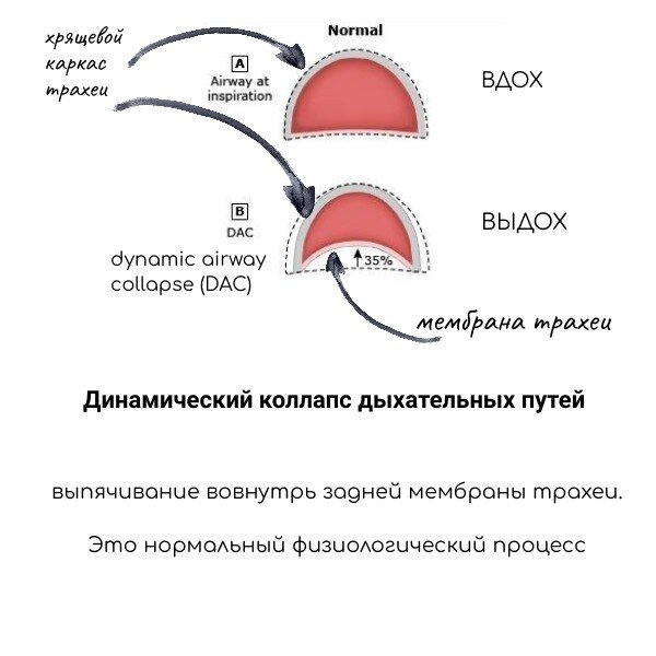 как самому проверить легкие