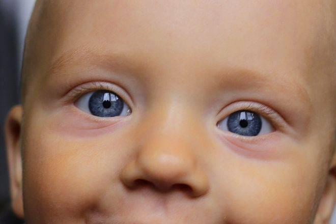 Почему у ребенка появились синяки под глазами