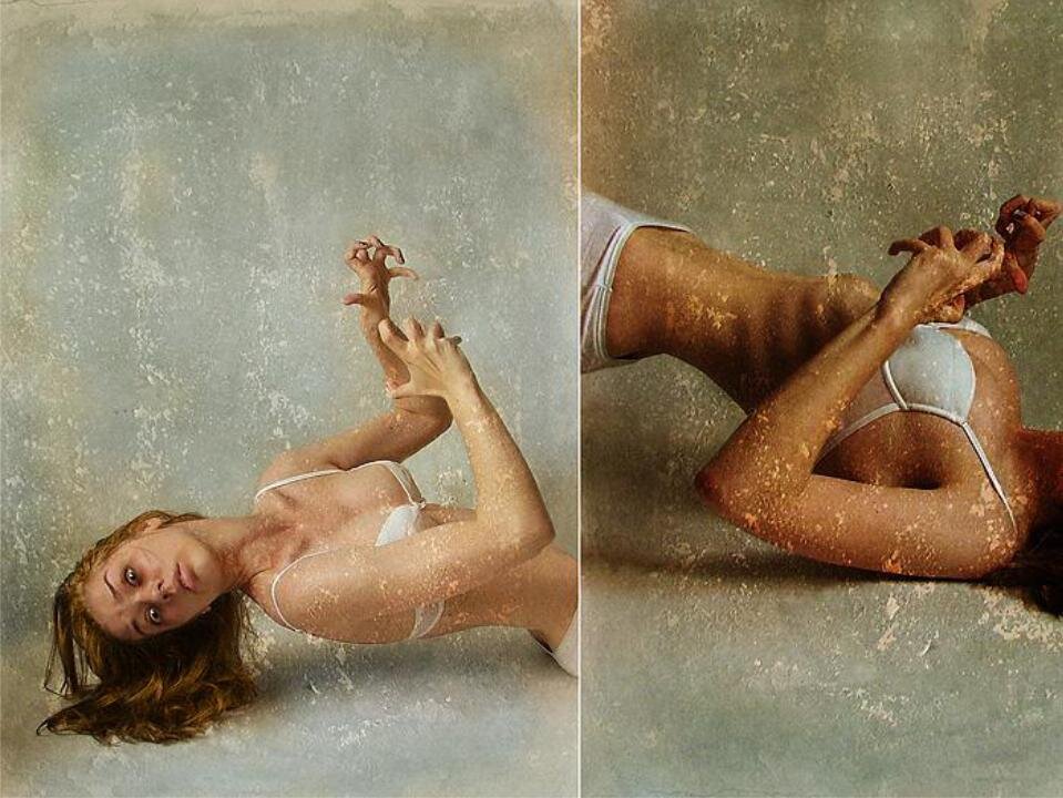 горделивая поза больного шизофренией. кататонические симптомы психиатрия. поза шизофрения. кататоническая шизофрения ступор. больной с манией величия.