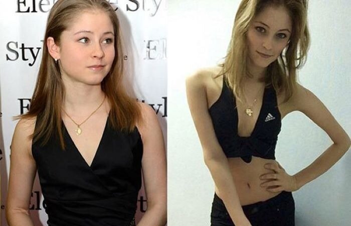 -2