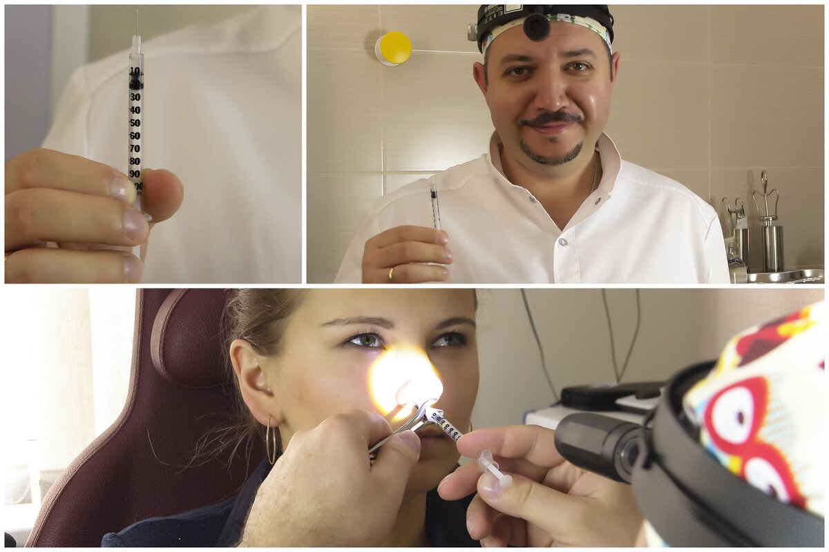 Хронический ринит. Лечим правильно | ЛОР КЛИНИКА ЗАЙЦЕВА | Дзен