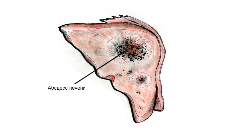 Фотография взята из источника vsepropechen.ru