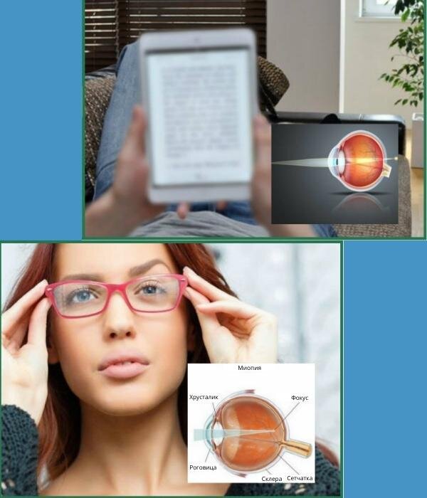 Картинка из источника https://glazclinic.com/kakiye-laboratorniye-issledovaniya-neobhodimiy.html