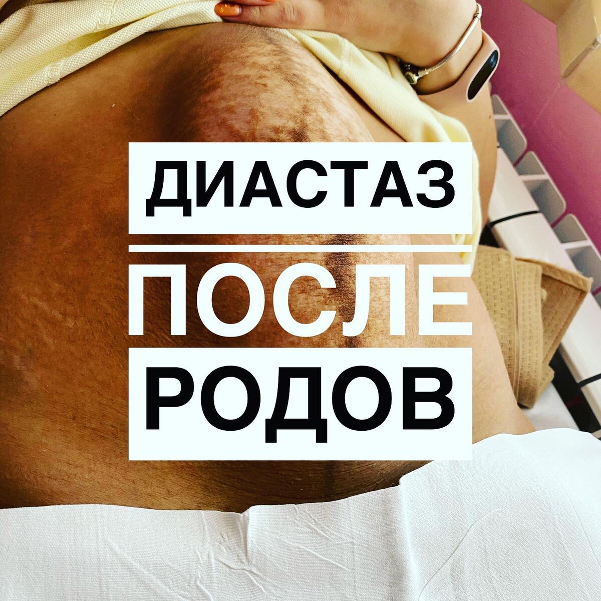 Секс после родов - когда можно и как предохраняться | Центр медицины плода на Чистых Прудах