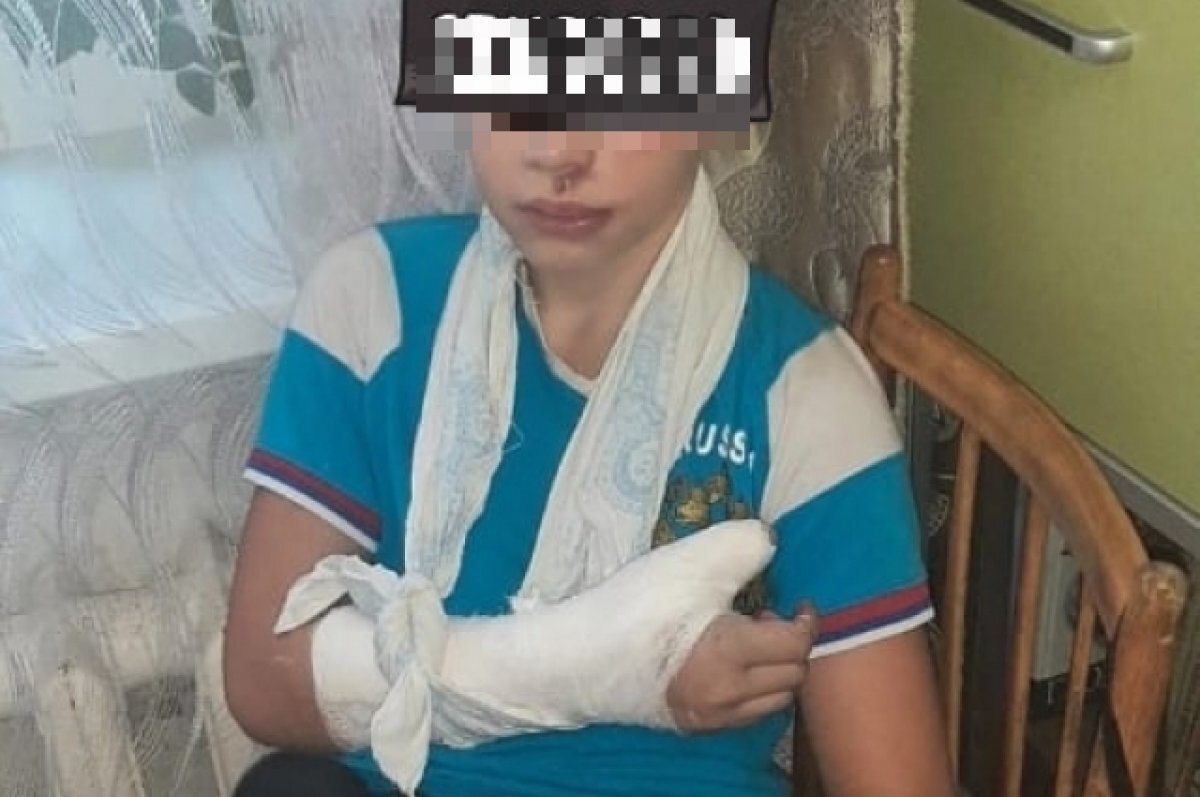    В Конаково с детской площадки ребенок вернулся с переломом и разбитым лицом