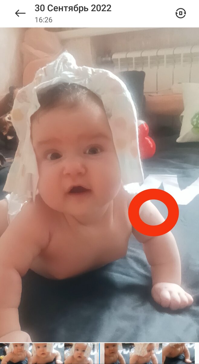 Фото нет, с видео скрин сделала. Это след через 2 недели после прививки. Достаточно маленький. 