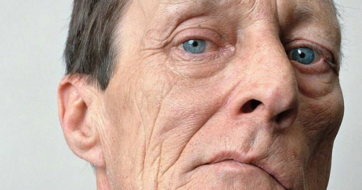 Кривое лицо во сне