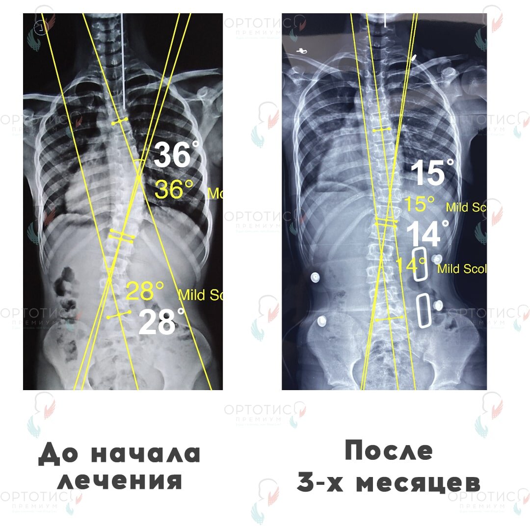 Больше результатов на сайте ortotis-premium.ru