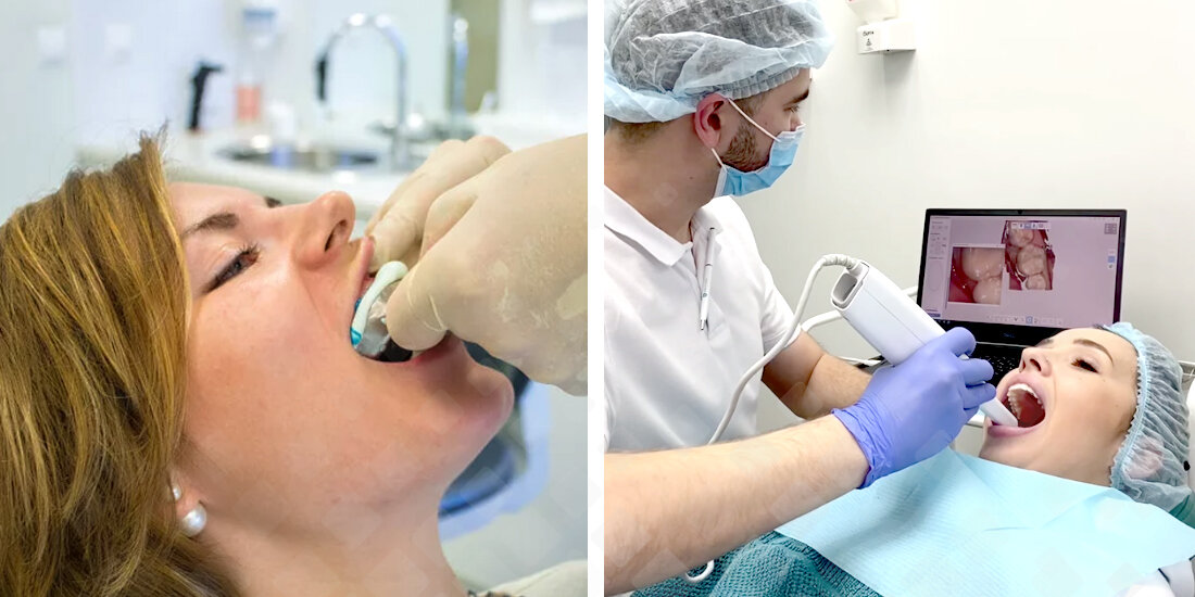 Снятие слепков с помощью оттискной массы (слева) и 3D-сканирование зубов (справа). Фотоколлаж: Smile-at-Once.ru.