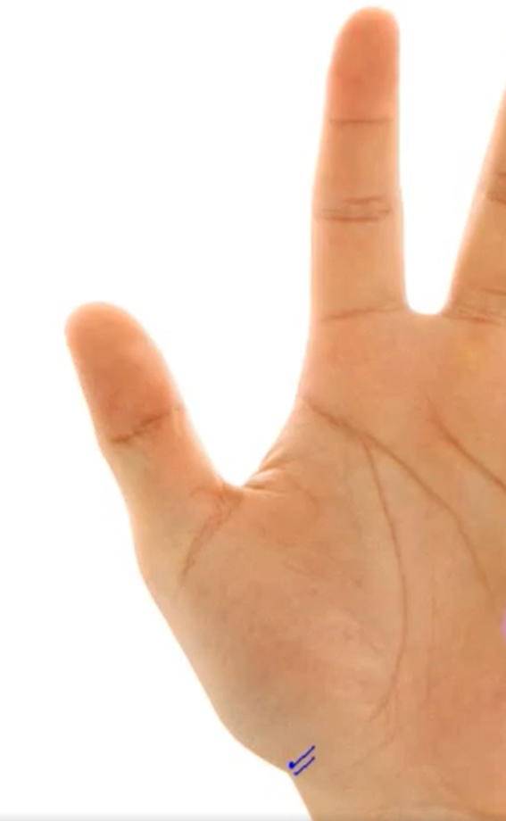 Косая линия на холме Венеры ближе к линии Жизни, говорит об абортах. 