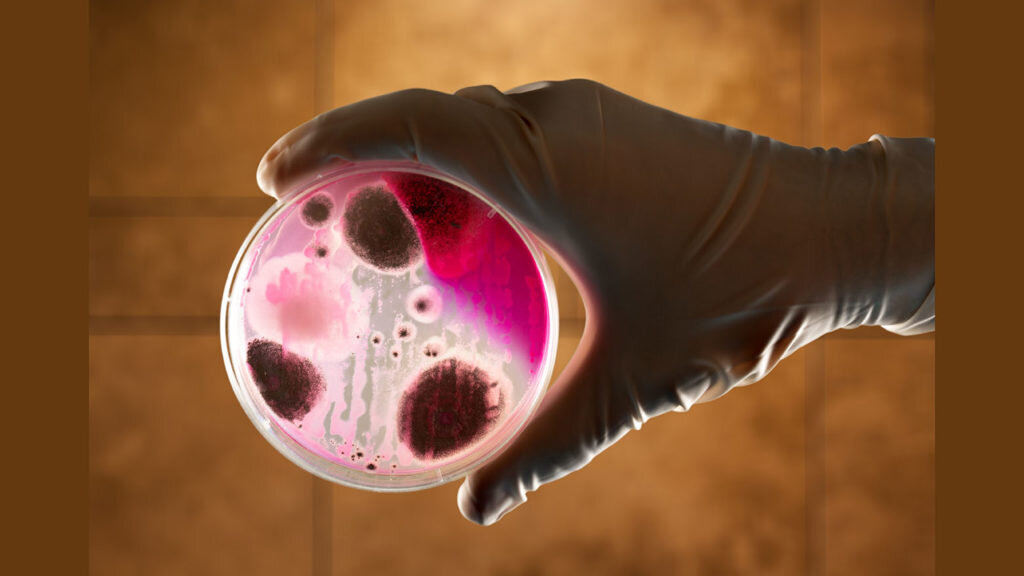    Anthrax bacterium petri dish microbiology science plate pathogen Александр Шереметьев