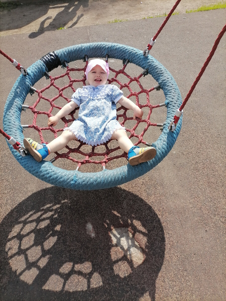 Фото из личного архива. 3-ий день после укуса комара. 