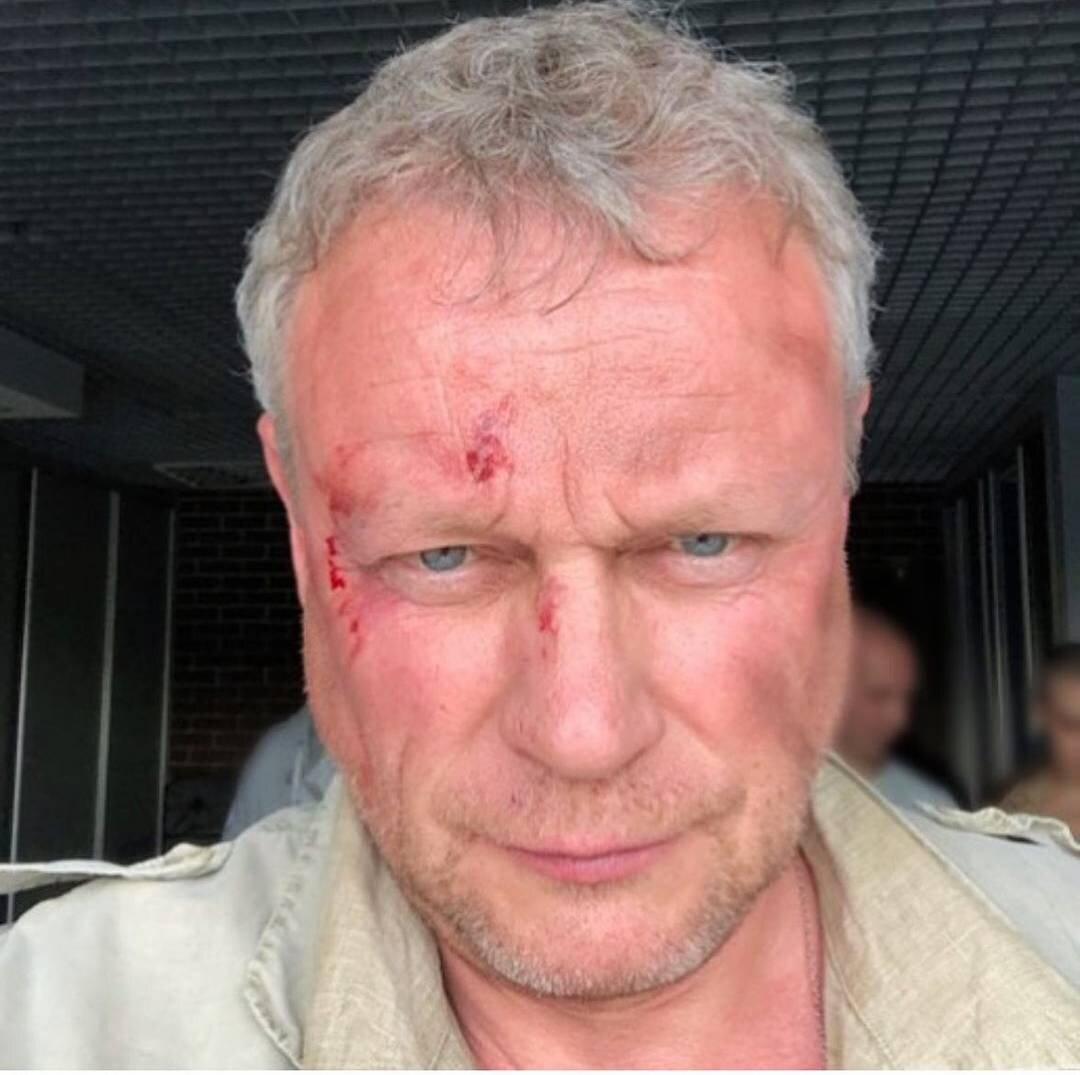    Сергея Жигунова с "избитым до крови лицом" показала его женаСоцсети Виктории Жигуновой