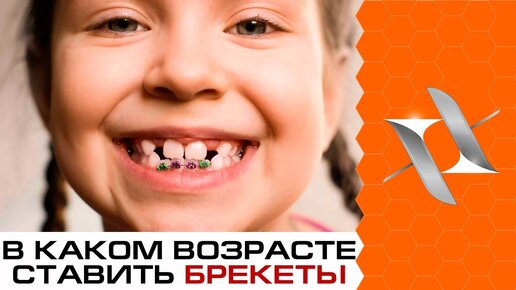 В каком возрасте начинать ортодонтию/ ставить брекеты?