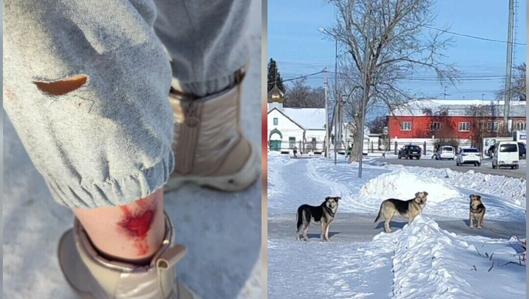     Следователи проверят информацию в социальных сетях о нападении на девушку бродячих собак в поселке Лузино. Должностные лица могут понести уголовную ответственность за халатность