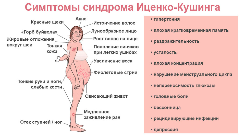 Как уменьшить кортизол в организме. Механизм развития симптомов синдрома Иценко Кушинга. Синдром Иценко-Кушинга этиология. Клинические проявления болезни Иценко Кушинга. Проявление болезни Иценко Кушинга механизм.