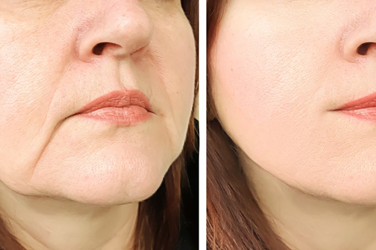    Молодой овал. Как вернуть лицу молодость?