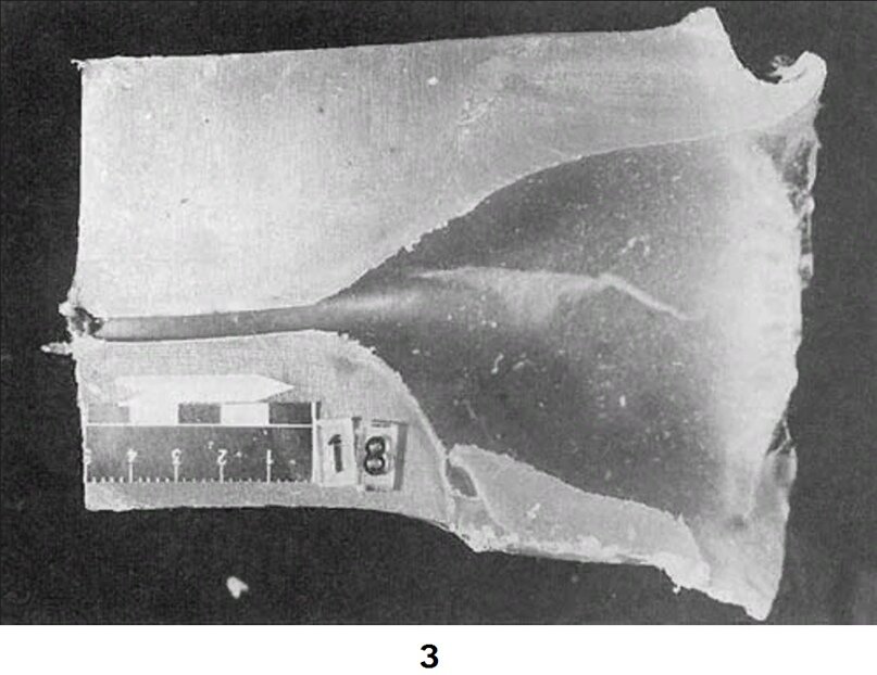 Пуля какие повреждения. Повреждения от экспансивных пуль. Экспансивные пули 7. Раневой канал пули 5. Экспансивная пуля 5.