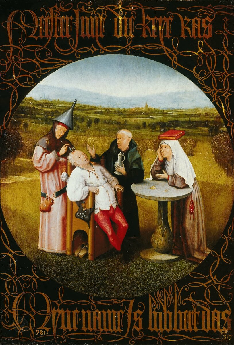 Операция на мозге. 1475—1480