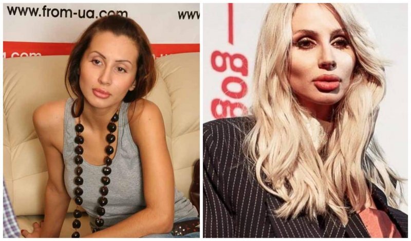 Светлана Лобода и её пластические операции. Что сделала певица, чтобы стать тако