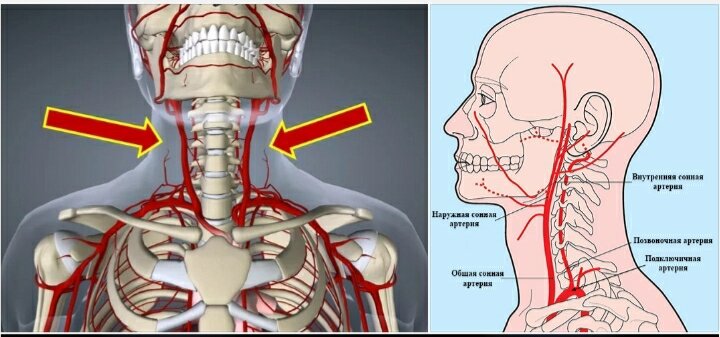 Артерии шеи фото. Сонные артерии на шее фото. Сосуды в шее пережимаются. Кровеносные сосуды в шейном отделе позвоночника.