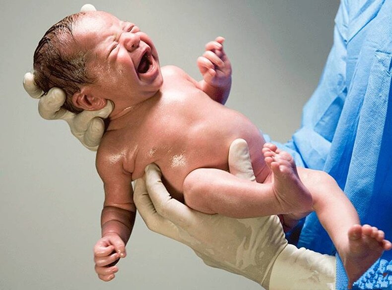    Когда ребенок появляется на свет, он кричит, наполняя легкие воздухом, но они к тому времени уже бывают загрязнены / © b17.ru