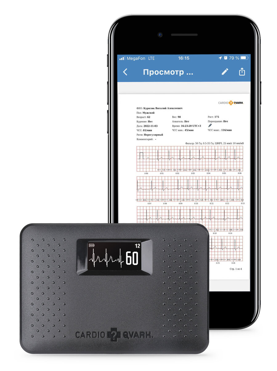 КардиоКАРТА для самостоятельной регистрации ритма сердца