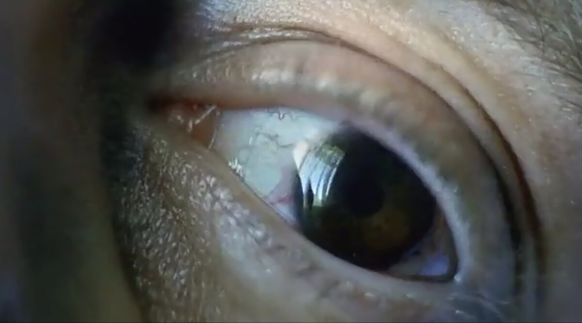 Кадр из фильма «Скафандр и бабочка»