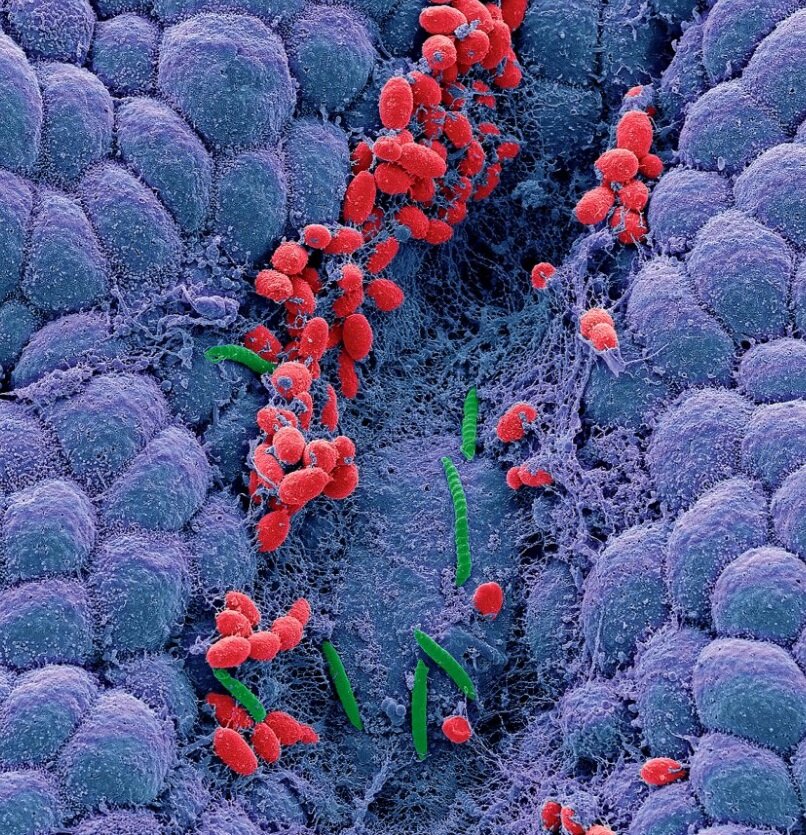 Желудок должен быть здоровым, без Helicobacter pylori. Как я решала ...