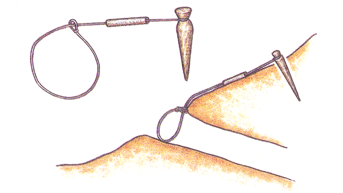 Норная петля