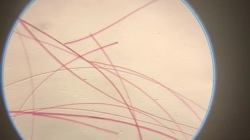 Up Close - What Is It? Hair under microscope, Things under a microscope, Hair ca